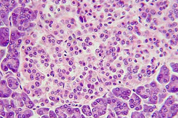 Nature Metabolism:皮下移植胰島細胞治療糖尿病-肽度TIMEDOO