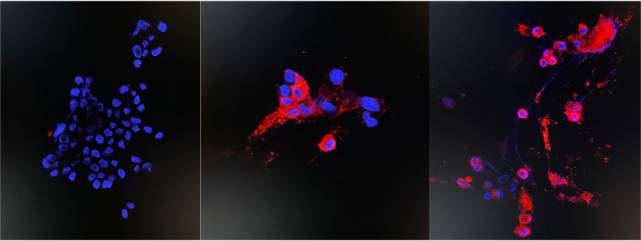 僅4天,香港大學(xué)微生物系團(tuán)隊(duì)成功分離奧密克戎毒株-肽度TIMEDOO