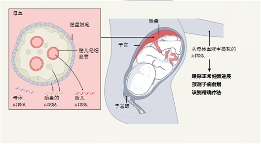 新研究用母親血液預(yù)測(cè)孕期先兆子癇風(fēng)險(xiǎn)-肽度TIMEDOO