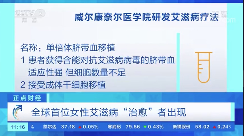 利用臍帶血干細胞療法 全球首位女性艾滋病“治愈”者出現(xiàn)-肽度TIMEDOO