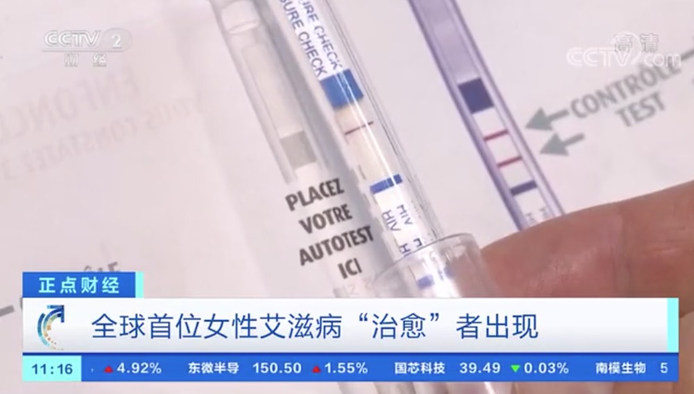利用臍帶血干細胞療法 全球首位女性艾滋病“治愈”者出現(xiàn)-肽度TIMEDOO