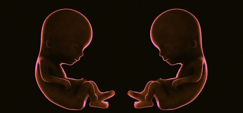 這對雙胞胎是在1992年冷凍的捐贈胚胎中誕生的-肽度TIMEDOO