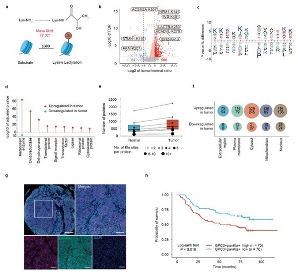 科學(xué)家繪制肝癌組織乳?；揎棃D譜-肽度TIMEDOO