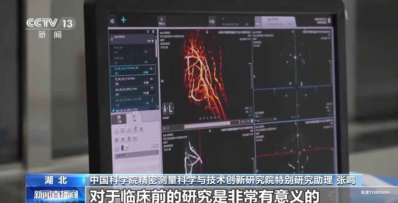 中國科學院團隊成功突破“多核”磁共振成像技術-肽度TIMEDOO
