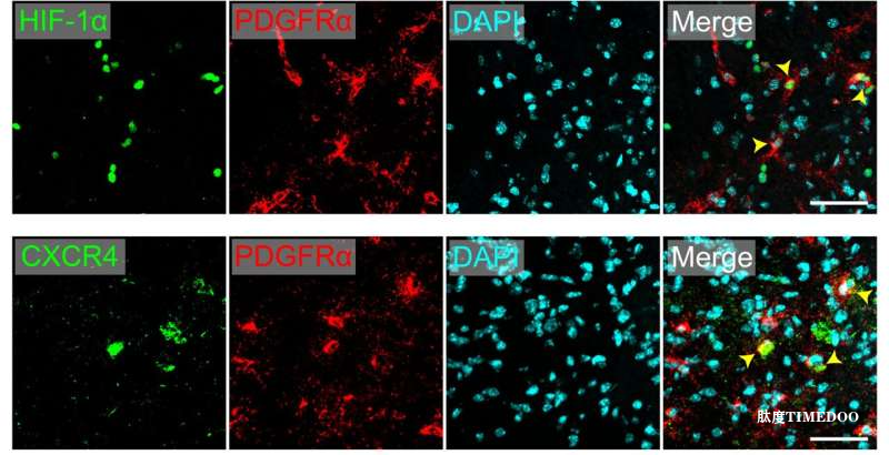 京都大學研究發(fā)現(xiàn)腦內膠質前體細胞可在缺氧條件下促進中風后血管再生-肽度TIMEDOO